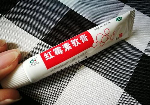 鳳仙花竟可以除菌？皮膚科專家揭秘 45天擺脫“丑指甲”的個人衛生指南